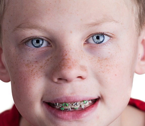 Child with phase one pediatric orthodontic treatment