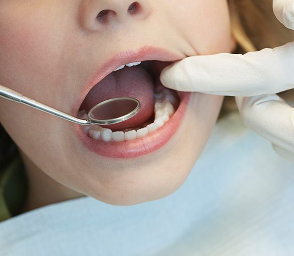 Dentist examining patient's smile after pulp therapy